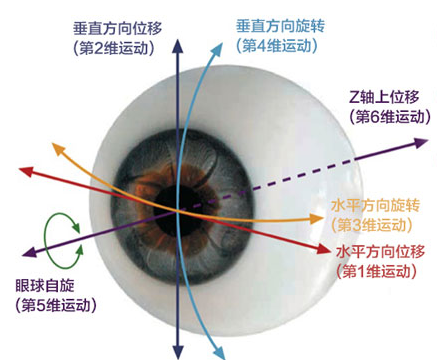 什么是睛逸手术（Smart全准分子激光手术）？ - 楚雄爱尔眼科医院